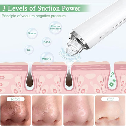 Blackhead Remover Pore Vacuum, 【[FDA Certification] 】 WiFi Visible Facial Pore Cleanser with HD Camera Pimple Acne Comedone Extractor Kit with 6 Suction Heads Electric Blackhead Suction Tool